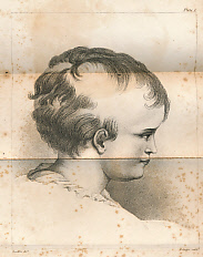 A Practical Treatise on Tinea Capitis Contagiosa, and Its Cure; With an Attempt to Distinguish This Disease From Other Affections of the Scalp: And a Plan for the Arrangement of Cutaneous Appearances, According to Their Origin and Treatment...