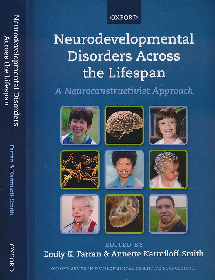 Neurodevelopmental Disorders Across the Lifespan. A Neuroconstructivist Approach
