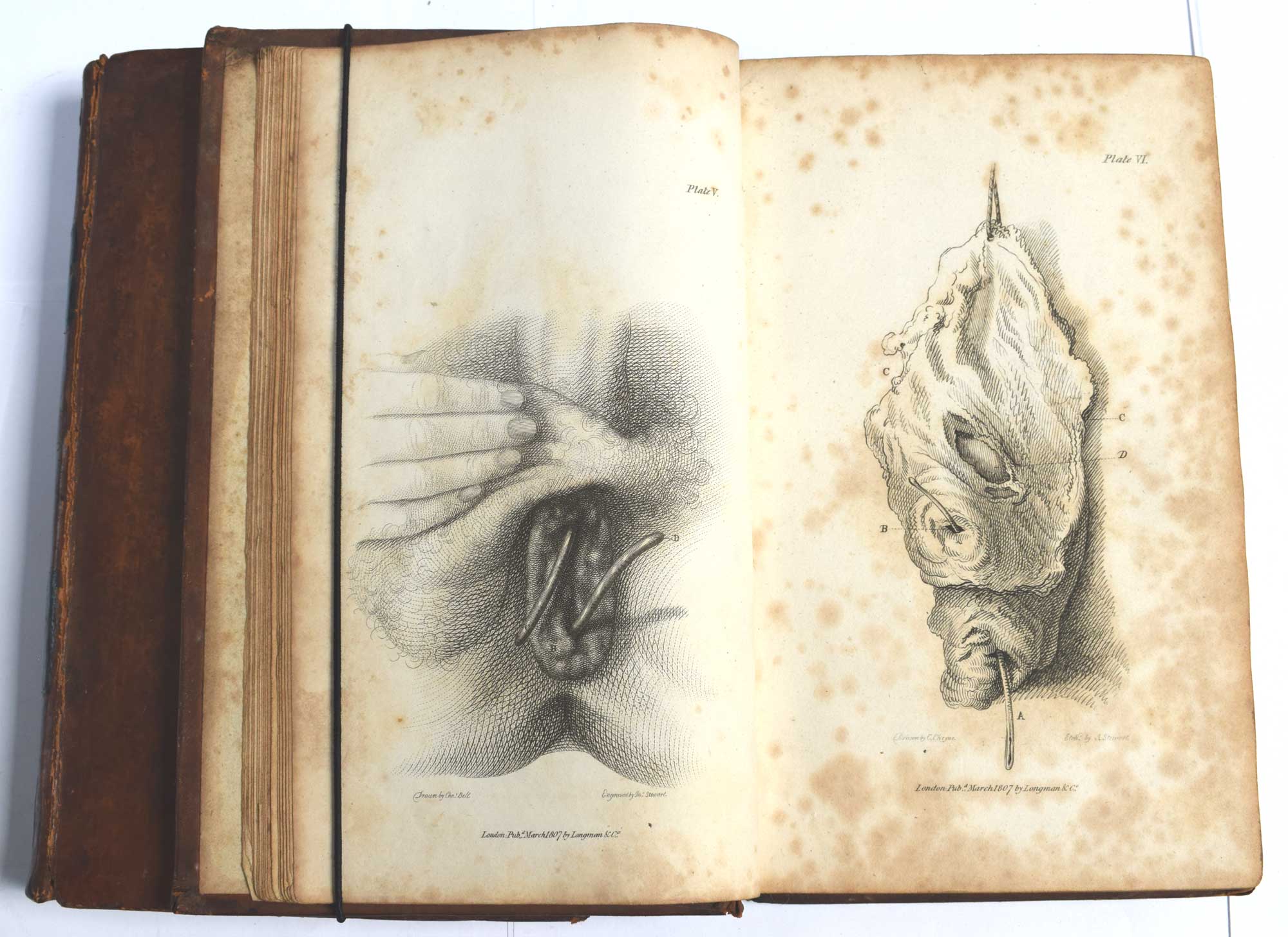 A System of Operative Surgery, Founded on the Basis of Anatomy. 2 Volume set.