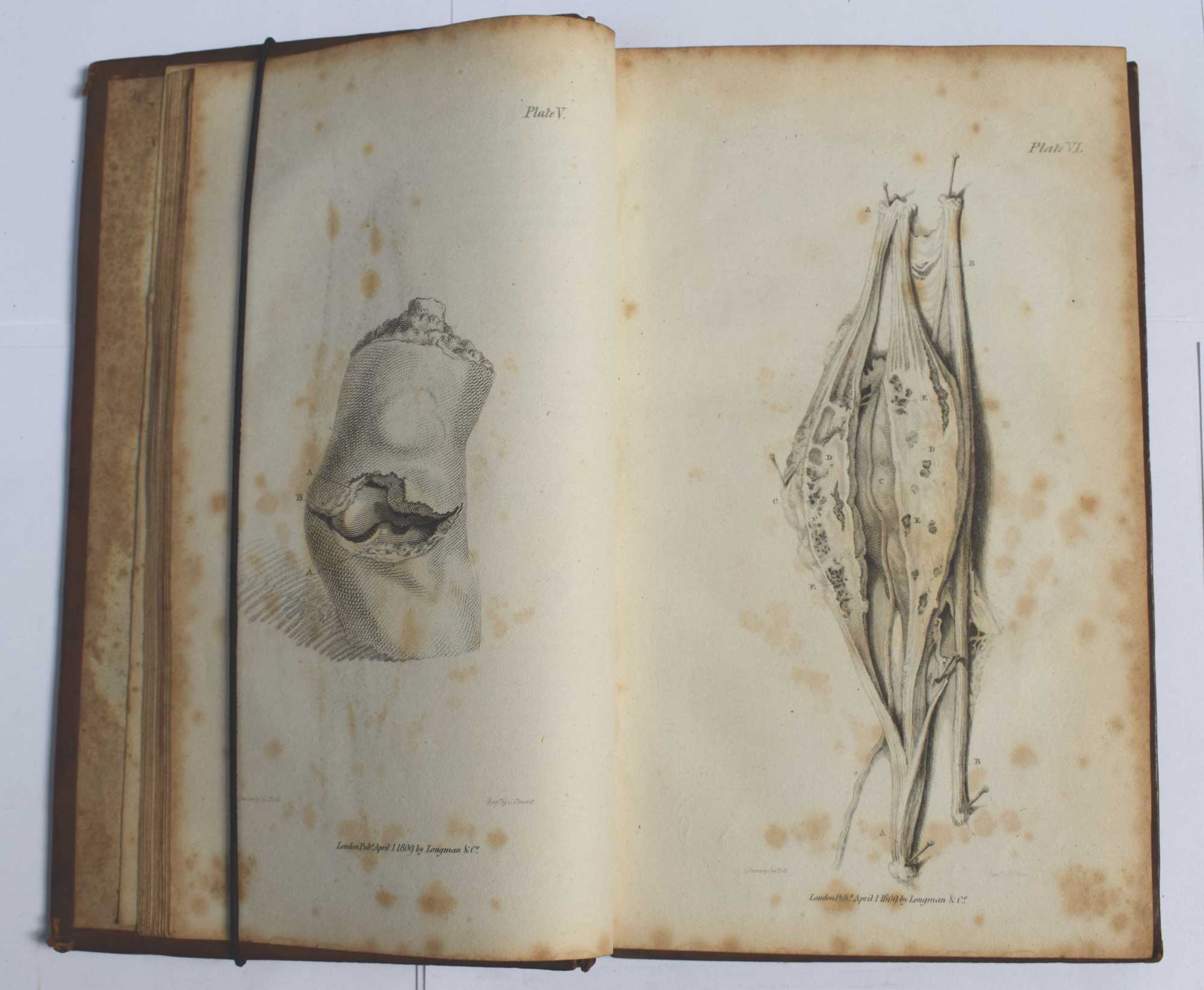 A System of Operative Surgery, Founded on the Basis of Anatomy. 2 Volume set.