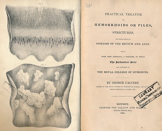 A Practical Treatise on Haemorrhoids or Piles, Strictures, and Other Important Diseases of the Rectum and Anus: Being with Some Additions, A Treatise, to which the Jacksonian Prize was Adjudged by the Royal College of Surgeons.