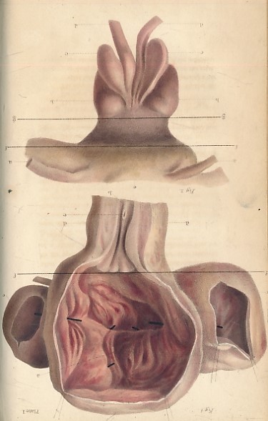 On the Anatomy and Diseases of the Neck of the Bladder and of the Urethra: Being the Substance of the Lectures Delivered in the Theatre of the Royal College of Surgeons in the Year 1830; and in the Westminster Hospital in 1833 & 1834.