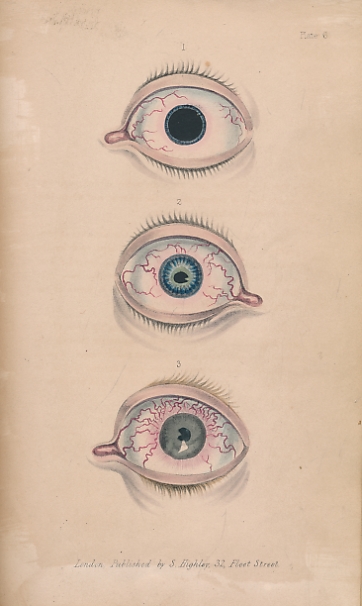 Lectures on Diseases of the Eye