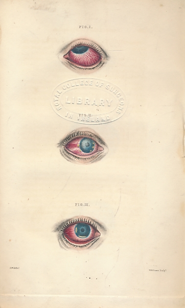 A Compendium of the Diseases of the Human Eye, Containing Descriptions and Explanations of the Various Diseases, Illustrated by Engravings, and Accompanied by Practical Observations on Their Treatment.