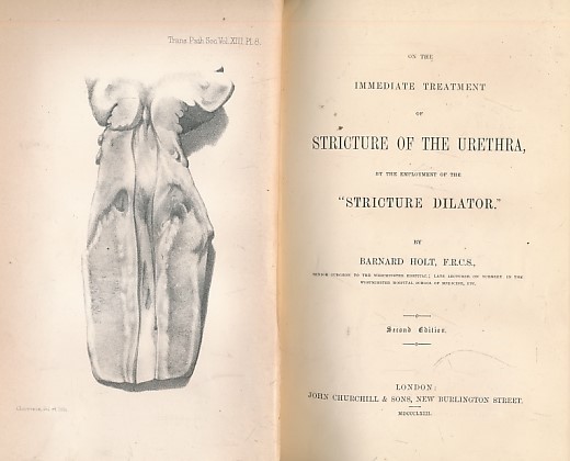 On the Immediate Treatment of Stricture of the Urethra, by the Employment of the 'Stricture Dilator'.
