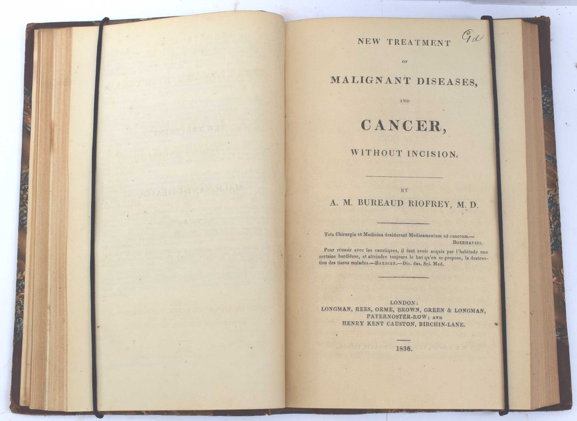 ..Whereby Cancerous Ulceration May be Stopped. [1]. On Scirrhus and Cancer [II]. New Treatment of Malignant Diseases and Cancer, Without Incision [III]. A Practical Essay on Cancer [IV]. Cases of Cancer and Cancerous Tendency [V]. 5 works in one volume.