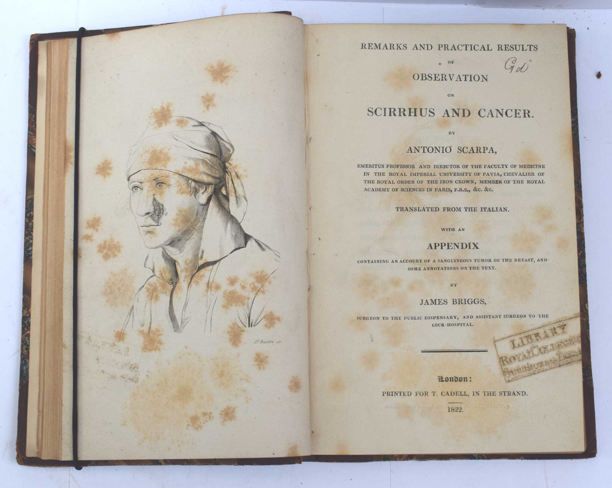..Whereby Cancerous Ulceration May be Stopped. [1]. On Scirrhus and Cancer [II]. New Treatment of Malignant Diseases and Cancer, Without Incision [III]. A Practical Essay on Cancer [IV]. Cases of Cancer and Cancerous Tendency [V]. 5 works in one volume.