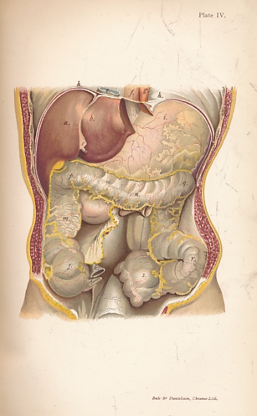 Ovariotomy and Abdominal Surgery