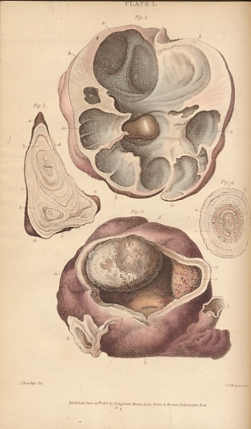 Practical Observations on the Diseases of the Urinary Organs; Particularly those of the Bladder, Prostrate Gland, and Urethra.