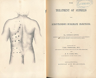 The Treatment of Syphilis with Subcutaneous Sublimate Injections
