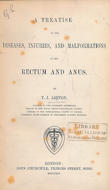A Treatise on the Diseases, Injuries, and Malformations of the Rectum and the Anus