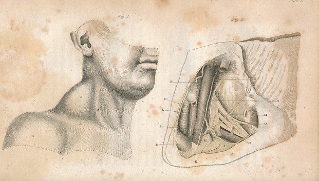 Observations on the Surgical Anatomy of the Head and Neck,  Illustrated by Cases and Engravings.