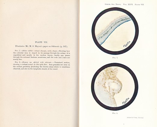 Transactions of the Ophthalmological Society of the United Kingdom. Volume XLVI (46). Session 1926.