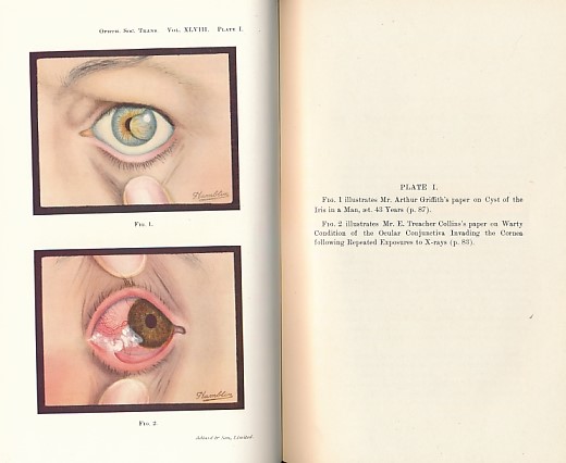Transactions of the Ophthalmological Society of the United Kingdom. Volume XLVIII (48). Session 1928.