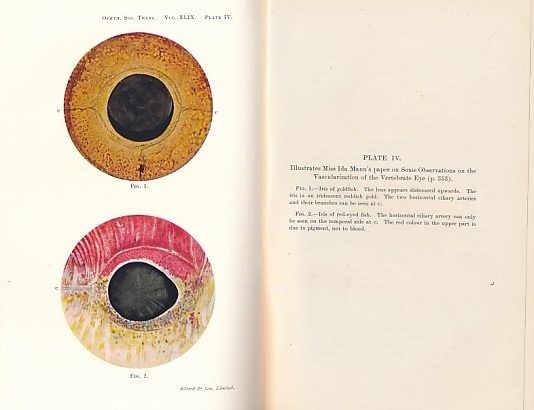 Transactions of the Ophthalmological Society of the United Kingdom. Volume XLIX (49). Session 1929.