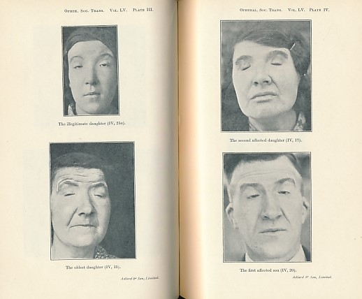 Transactions of the Ophthalmological Society of the United Kingdom. Volume LV (55). Session 1935.