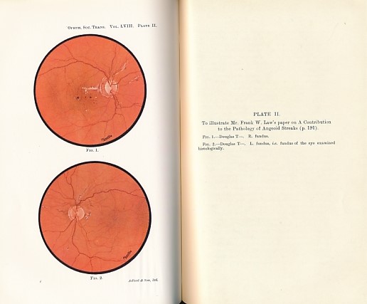 Transactions of the Ophthalmological Society of the United Kingdom. Volume LVIII (58) Part I. Session 1938.