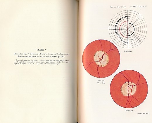 Transactions of the Ophthalmological Society of the United Kingdom. Volume LIX (59) Part II. Session 1939.