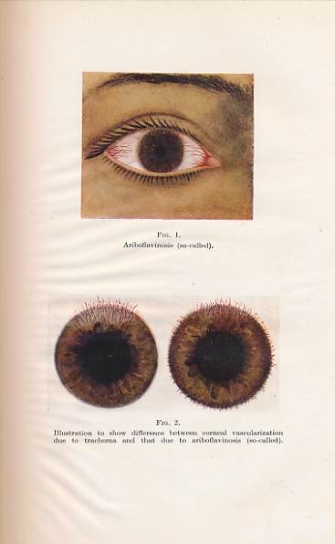 Transactions of the Ophthalmological Society of the United Kingdom. Volume LXVI (66). Session 1946.