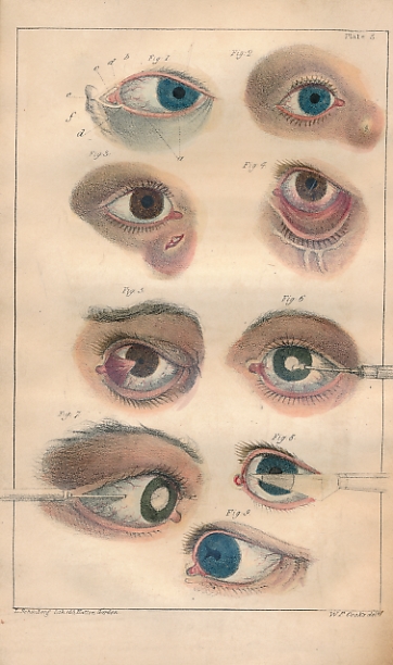 A Concise Treatise on Operative Surgery, Describing the Methods Adopted by the English, Continental, and American Surgeons; Selected for the Use of Junior Practitioners and Students.