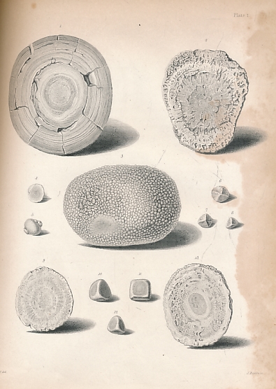 A Descriptive and Illustrated Catalogue of the Calculi and Other Animal Concretions Contained in the Museum of the Royal College of Surgeons in England. 3 volume set.